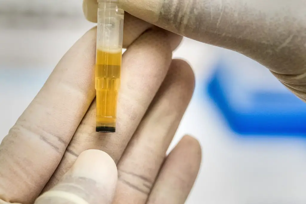 Is there DNA in urine